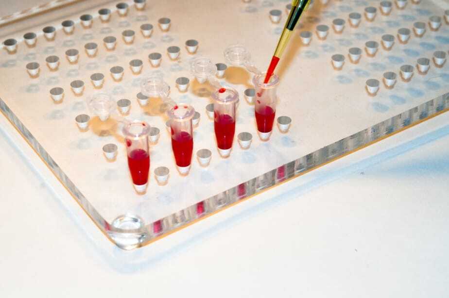 testing blood from the newborn for ABO incompatibility