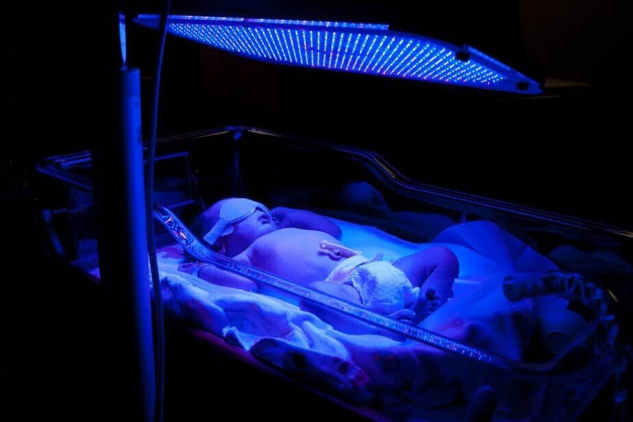 newborn receiving phototherapy to treat jaundice