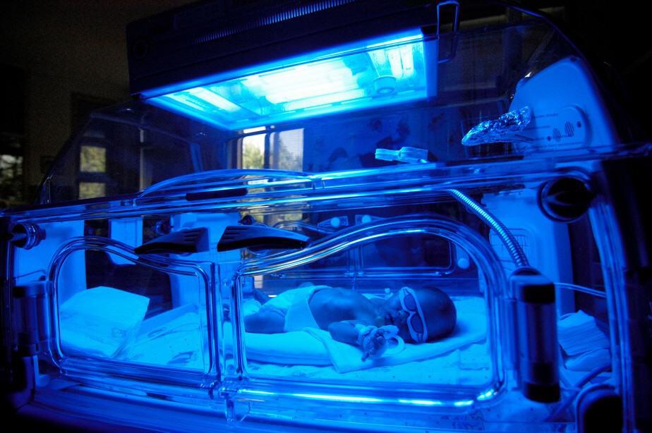 newborn with jaundice receiving phototherapy