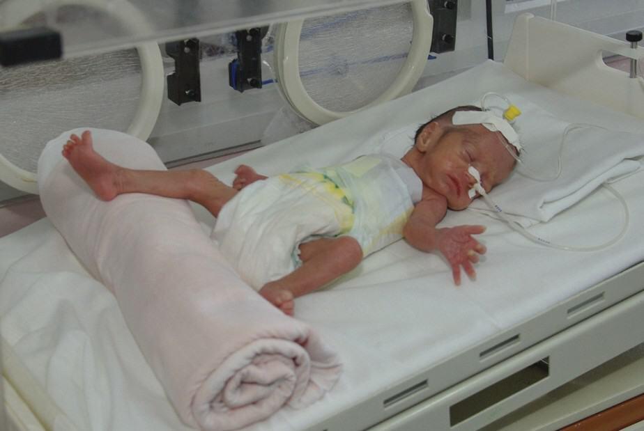 preemie with NEC in NICU